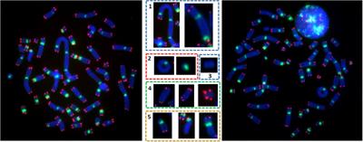 Is Response to Genotoxic Stress Similar in Populations of African and European Ancestry? A Study of Dose-Response After in vitro Irradiation